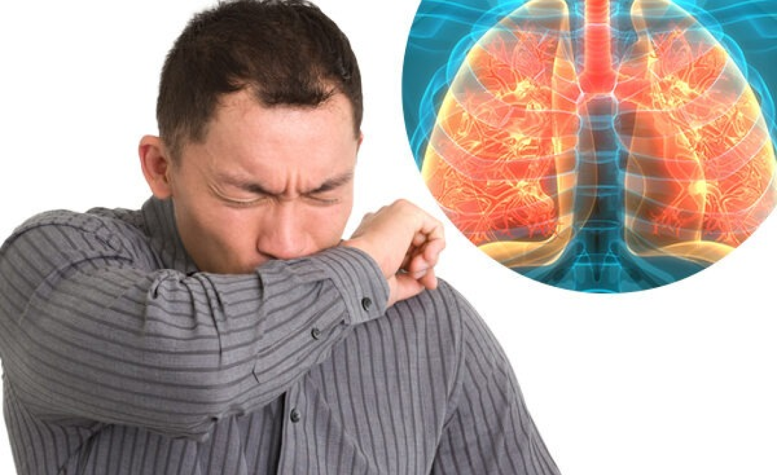 Tuberculose: prevenção, diagnóstico e tratamento gratuito